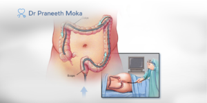 Best gastroenterologist