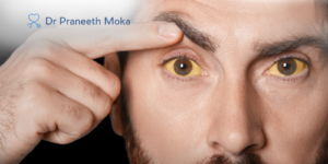 trusted gastroenterologist in Hyderabad