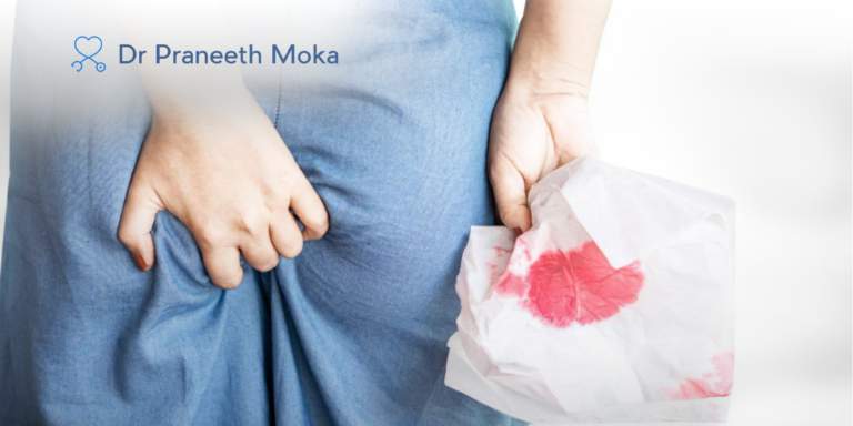 trusted gastroenterologist in Hyderabad