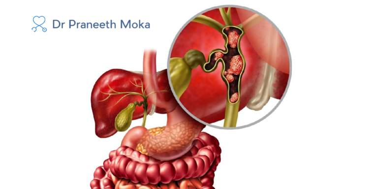 gastroenterologist in Hyderabad