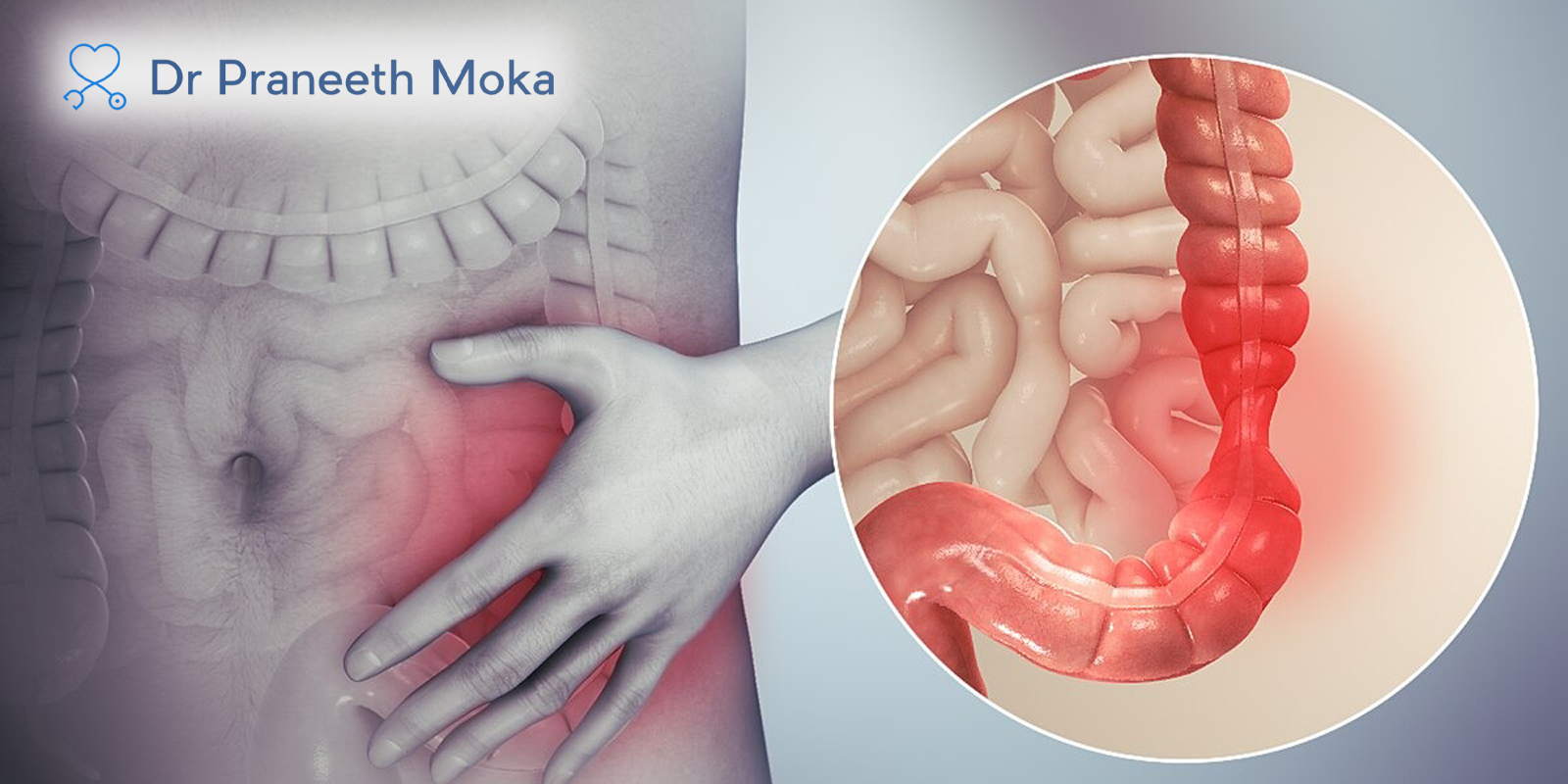 Gastroenterologist in Narsingi