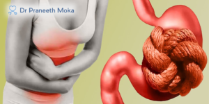 Best Gastroenterologist in Narsingi