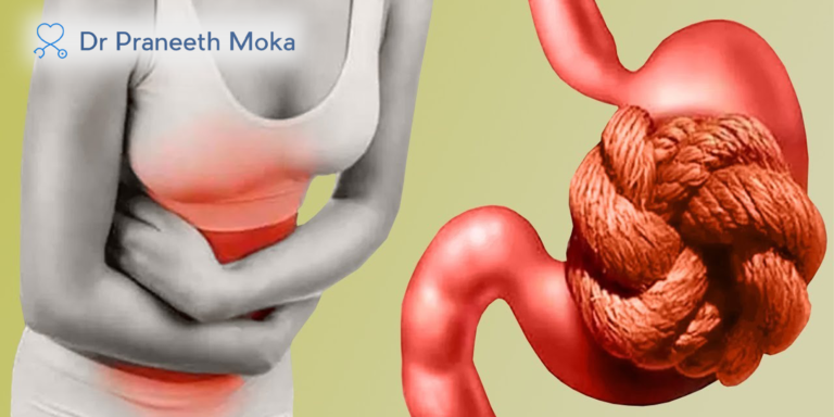 Best Gastroenterologist in Narsingi