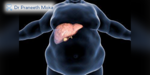 Best Gastro Doctor in Hyderabad