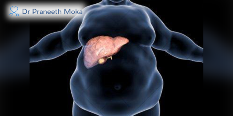 Best Gastro Doctor in Hyderabad