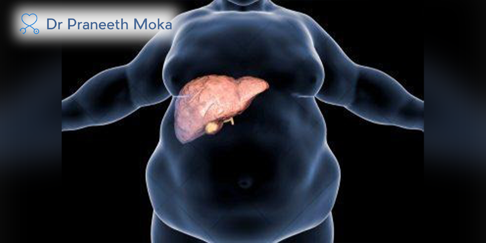 Best Gastro Doctor in Hyderabad